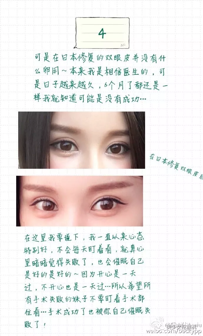 双眼皮的魅力，照片背后的故事