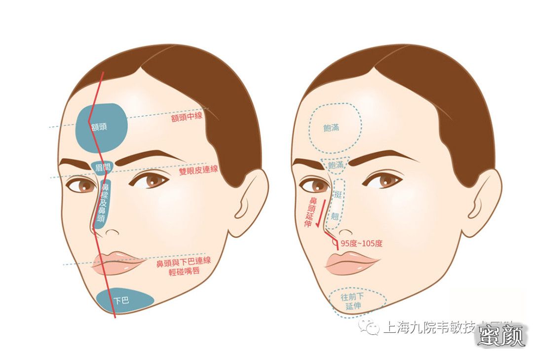 脸整形的探索与思考