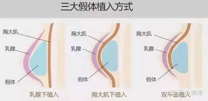 第1414页