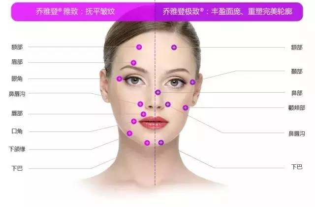 玻尿酸除皱，重塑青春的秘诀