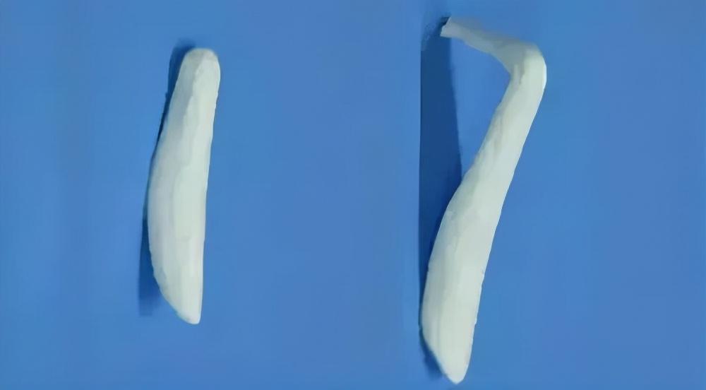 膨体硅胶隆鼻，重塑美丽鼻型的理想选择
