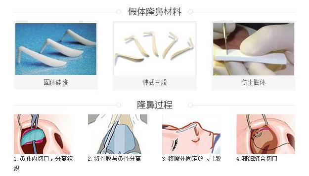 第1411页
