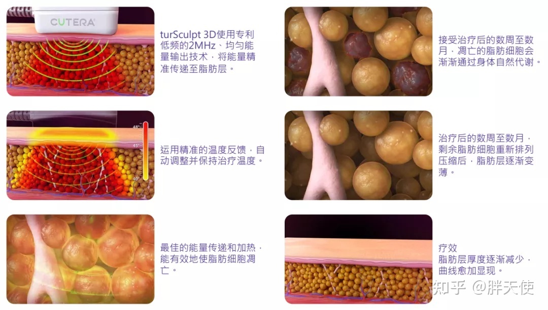 整形吸脂，重塑美丽，追寻自信