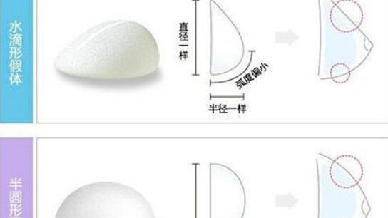 妙桃假体价格解析，多少钱？