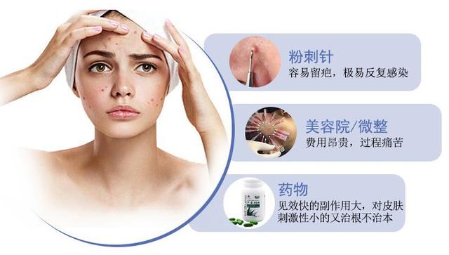 激光光子嫩肤，重塑肌肤的年轻光彩