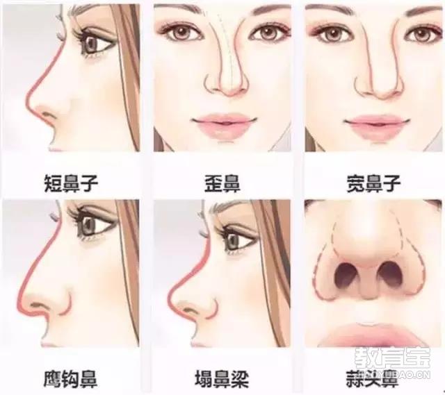 玻尿酸隆鼻，塑造完美鼻型的图片解析