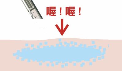 注射隆胸需要多少钱，深入了解与全面解析