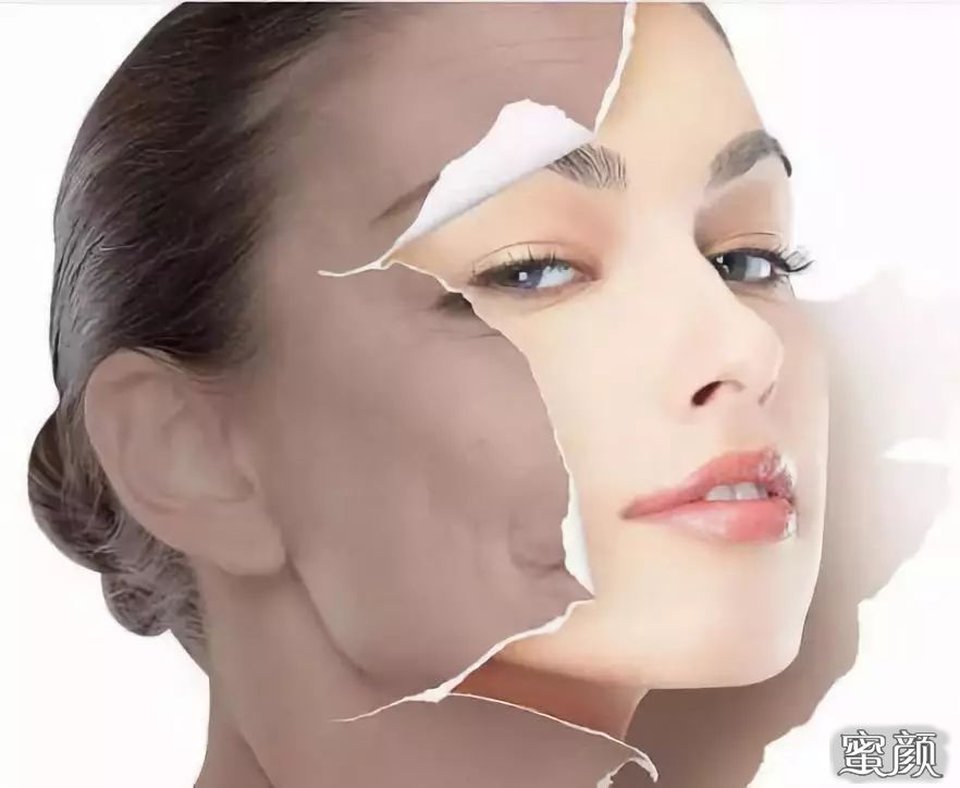 拉皮除皱价格，深度解析与影响因素探讨