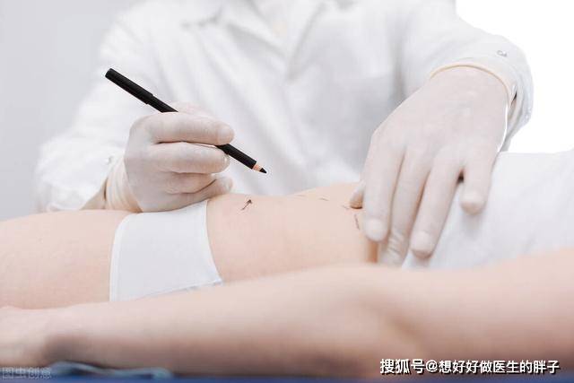 减肥吸脂术，重塑自信之道的探索之旅