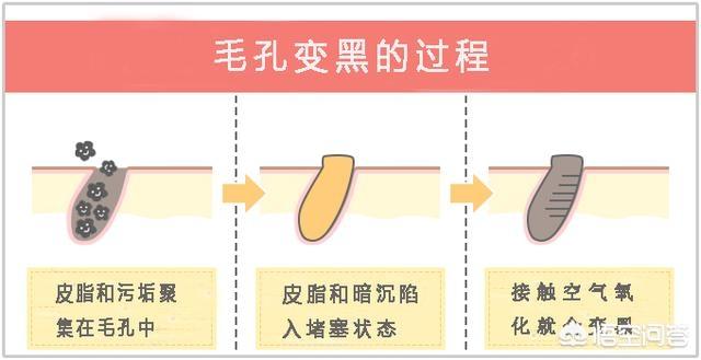大鼻子整形价格，全面解析费用因素与选择策略