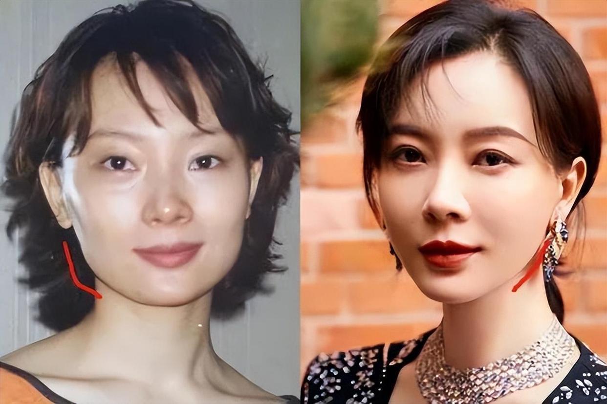 明星整容前后照片，揭秘美丽的背后故事
