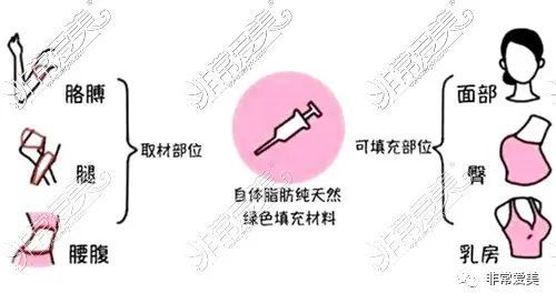 抽脂隆胸价格详解，因素、费用及注意事项