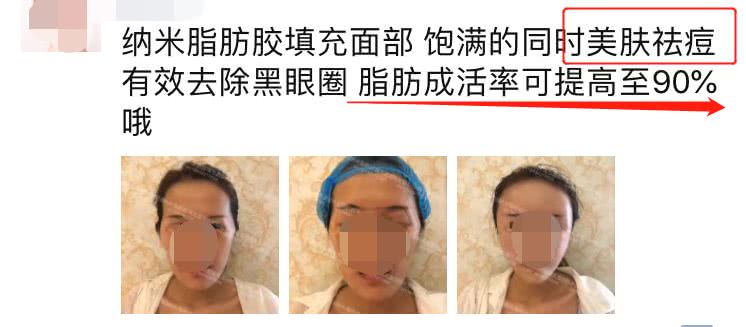 美丽轮廓重塑