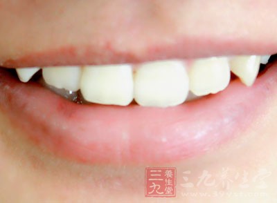 牙齿冷光美白费用详解，多少钱让你拥有灿烂笑容？