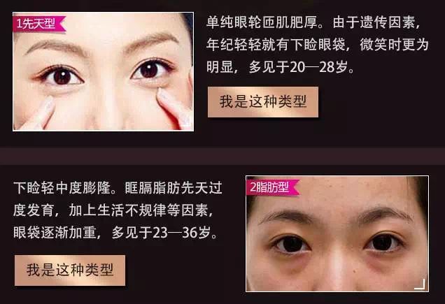 消除眼袋手术，重塑眼部魅力的秘密武器