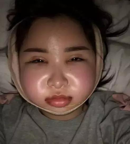 全面整容费用解析，全脸整容需要多少钱？