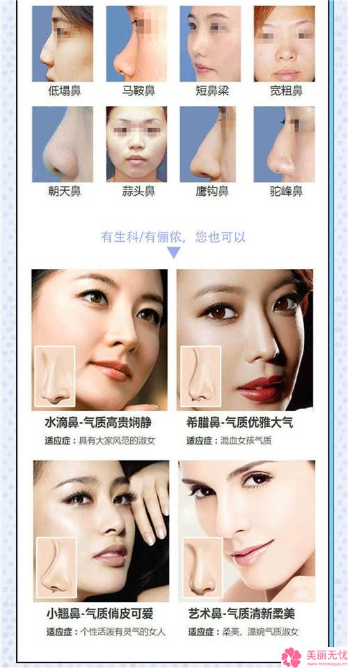 注射隆鼻价格多少，全面解析隆鼻成本与因素