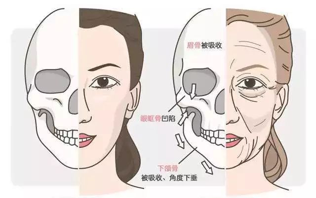 下巴骨整形术，重塑面部轮廓的艺术与科学