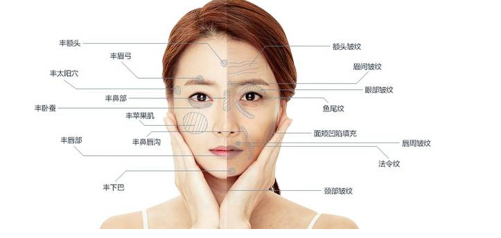 面部自体脂肪填充，重塑美丽轮廓的自然选择
