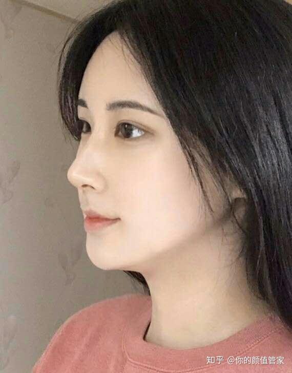 完美鼻型重塑