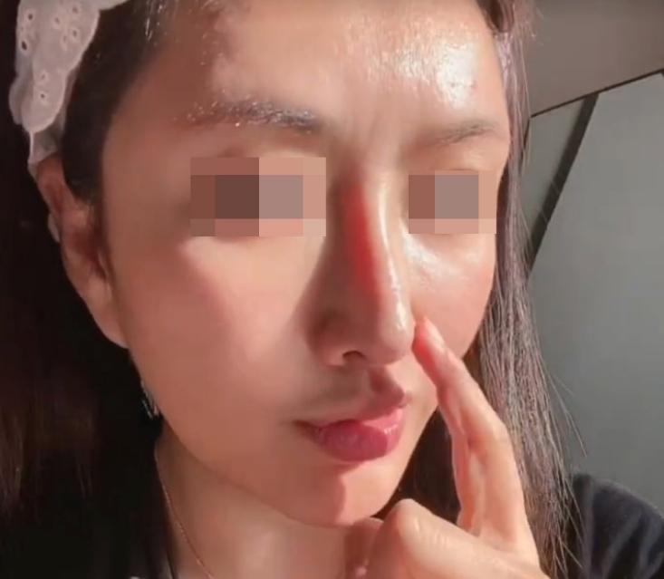 探究隆鼻整形费用，了解因素与选择策略