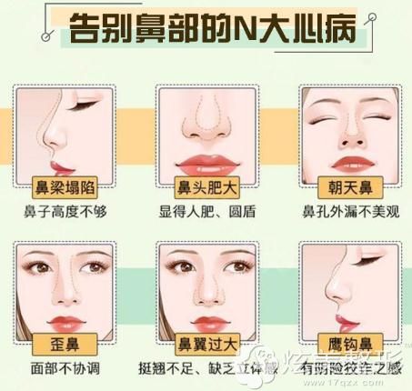 重塑自信与美丽