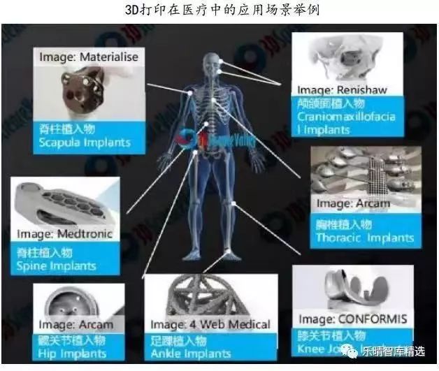 揭秘常见的三种3D打印技术及其应用领域